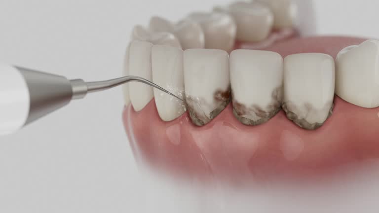 Reliable Wisdom Tooth Removal contractor in Eaton County County, MI by Dentist Open Now